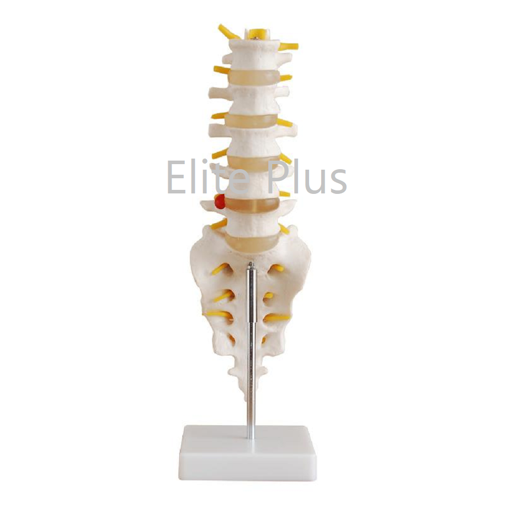 Cart XC 119 Life Size Lumbar Vertebrae with Sacrum Coccyx and Herniated Disc